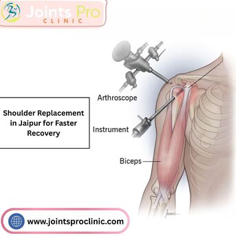 Jaipur, Health, Shoulder Replacement In Jaipur For Faster Recovery