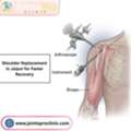 Shoulder Replacement In Jaipur For Faster Recovery