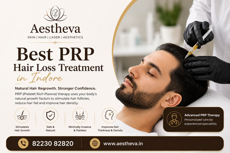 Indore, Health, Best PRP Hair Loss Treatment In Indore