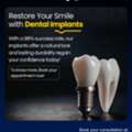Dental Implants In Kokapet