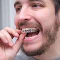 Trusted Orthodontist Near Me In Centennial, CO | Modern Smile Solutions