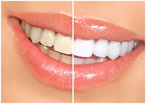 Miami, Dental, Affordable Dentistry - We Make Smiles