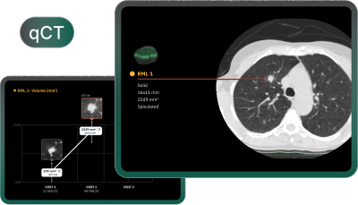 New York, Health, AI Solutions In Healthcare For Radiology Workflows