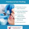 Gum Disease Treatment In Tirunelveli