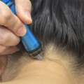 Musee Platinum Tokyo &ndash; Professional Dandruff Treatment For A Healthier Scalp