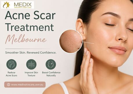 Melbourne, Health & Beauty Items, Expert Acne Scar Treatment Melbourne | Medix Skincare