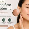 Expert Acne Scar Treatment Melbourne | Medix Skincare