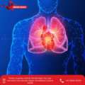 Consult Dr. Mihir Shah For The Best Lung Cancer Treatment In Ahmedabad