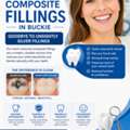 🪥 Natural-Looking Composite Fillings In Buckie — Goodbye To Unsightly Silver Fillings