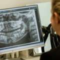 Learn About The Wisdom Teeth Removals Of The Nearby Dental Clinic In Ormeau City