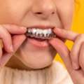 Braces Orthodontics For Better Smile Care