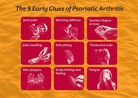 Pune, Guest Posting, The Gut-skin-joint Connection Behind Psoriatic Arthritis That Most People Never Learn Abou