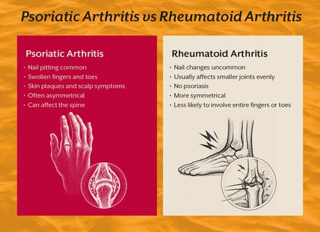 Pune, Guest Posting, The Gut-skin-joint Connection Behind Psoriatic Arthritis That Most People Never Learn Abou
