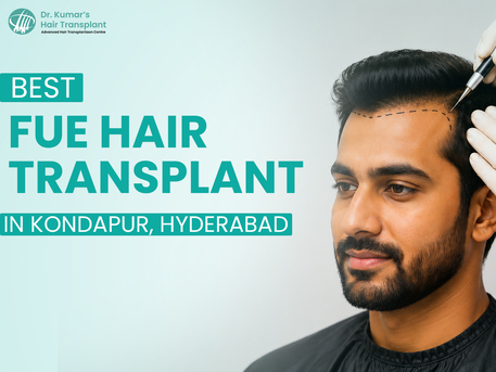 New Delhi, Health, FUE Hair Transplant In Hyderabad To Restore Hair Density Naturally