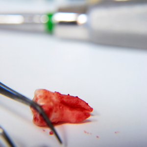 Melbourne, Health & Beauty Items, How Dentist Emergency Services Help During Dental Issues
