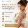 Advanced Skin Treatments In Kompally Hyderabad For Healthy, Glowing Skin