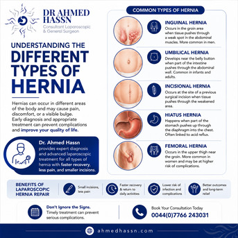 Dubai, Health, Looking For An Expert Upper GI Surgeon In Dubai? Consult Dr. Ahmed Hassn.