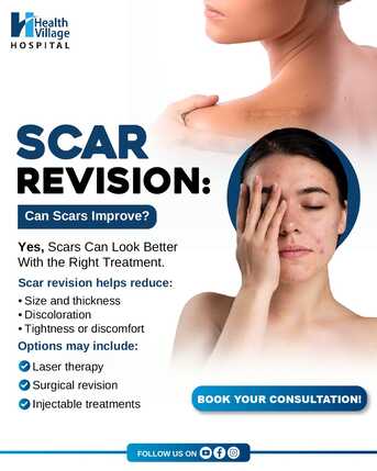 Mumbai, Health, Scar Revision Surgery: Modern Solutions For Old Scars | Best Plastic Surgery Hospital In O