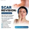 Scar Revision Surgery: Modern Solutions For Old Scars | Best Plastic Surgery Hospital In O