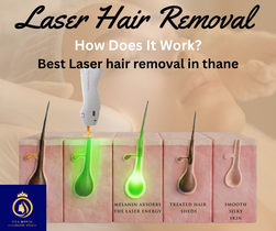 Thane, Fashion & Design, Achieve Smooth Skin With Best Laser Hair Removal In Thane By DNA Royal.