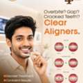 Clear Aligners In Hyderabad &ndash; Dr Smiles Dental Clinic