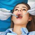 Teeth Cleaning In NIBM Pune | Professional Dental Scaling & Polishing
