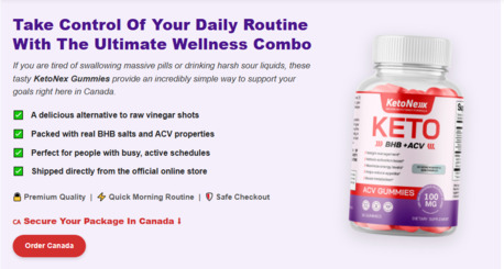 Toronto, Health & Beauty Items, CAD 31,  Unbiased KetoNex ACV Gummies Reviews: Pros, Cons, And User Insights