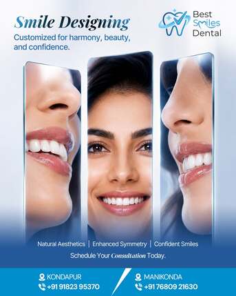 Hyderabad, Dental, Smile Designing In Kondapur, Hyderabad &ndash; Best Smiles Dental