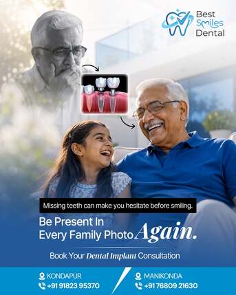 Hyderabad, Dental, Dental Implants In Hyderabad &ndash; Best Smiles Dental