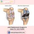 Joint Replacement Surgeon In Jaipur For Joint Health