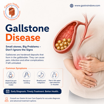 Indore, Health, Barrett&rsquo;s Oesophagus Treatment In Indore By GI Experts