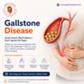 Barrett&rsquo;s Oesophagus Treatment In Indore By GI Experts