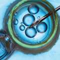 IVF Treatment Cost In Delhi - Dr Rhythm Gupta