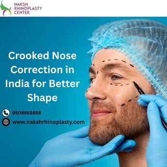 Mumbai, Health, Crooked Nose Correction In India For Better Shape