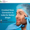 Crooked Nose Correction In India For Better Shape