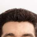 Expert SMP For Hairline Restoration | Skulltec
