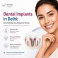 Dental Implants In Delhi: Everything You Need To Know