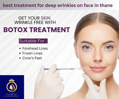 Thane, Fashion & Design, Best Treatment For Deep Wrinkles On Face In Thane | DNA Royal Advanced Skin Clinic.