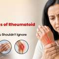 Symptoms Of Rheumatoid Arthritis: Early Signs You Shouldn&rsquo;t Ignore