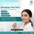 Clear Braces Treatment In Nanakramguda