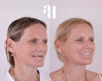 Sydney, Health, Cosmetic Dentist Penrith - Avira Dental