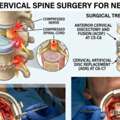 Specialized Cervical Spine Surgery For Neck Disorders