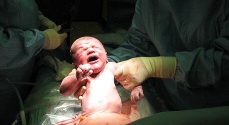 Mumbai, Health, Safe Cesarean Delivery Care In Bhagalpur Bihar For Mothers