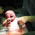 Safe Cesarean Delivery Care In Bhagalpur Bihar For Mothers