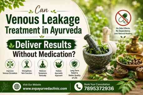 Auckland, Health, Can Venous Leakage Treatment In Ayurveda Deliver Results Without Medication?