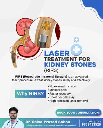 Mumbai, Health, RIRS Laser Treatment For Kidney Stones | Dr. Shiva Prasad Sahoo