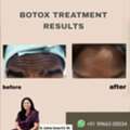 Rewind The Clock With Botox - Derma One Vizag