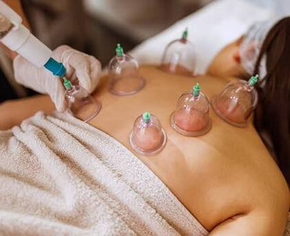 Gurgaon, Businesses For Sale, Cupping Therapy Services: Natural Pain Relief And Holistic Healing