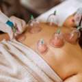 Cupping Therapy Services: Natural Pain Relief And Holistic Healing