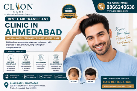 Ahmedabad, Health, Best Hair Transplant In Gujarat In Ahmedabad